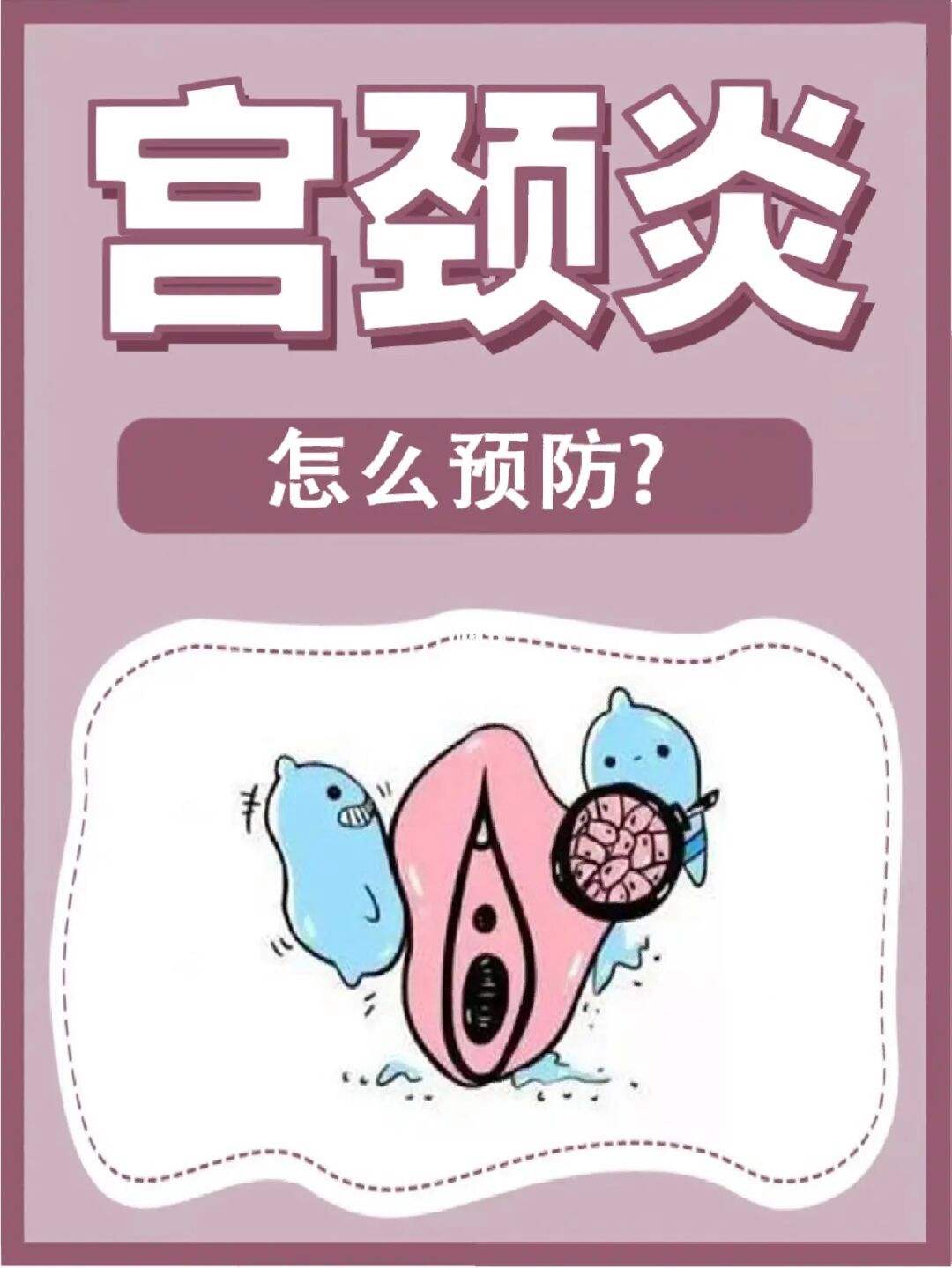 宮頸炎的常見病因是什麼.jpg 宮頸炎的常見病因是什麼.jpg