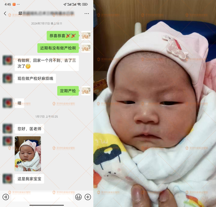 結紮十年也能自然懷孕|深圳怡康婦產醫院複通手術案例分享