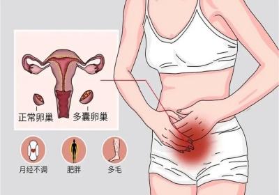 月經不調看什麼科?如何快速治療?