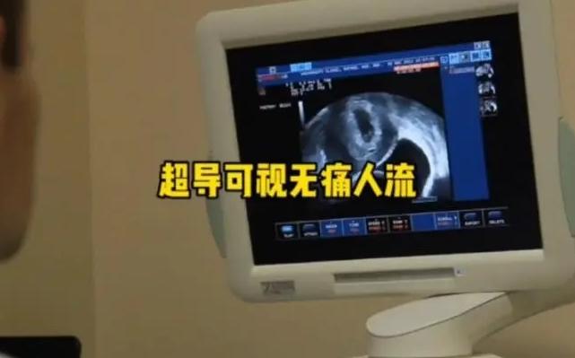 超導可視無痛人流術：精準定位減少子宮損傷的現代技術
